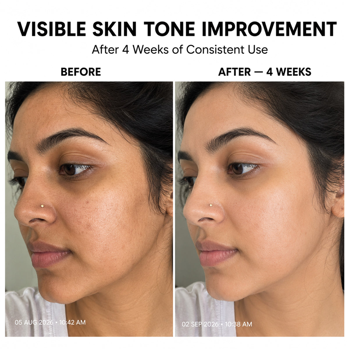 Nano Kojic Acid Face & Body Brightening Soap – 150g