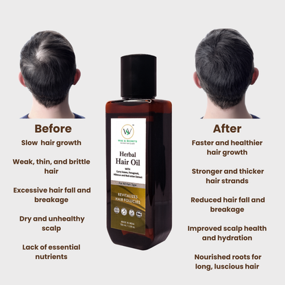 Red Onion Extract + Curry Leaves Herbal Hair Oil - 100 ML