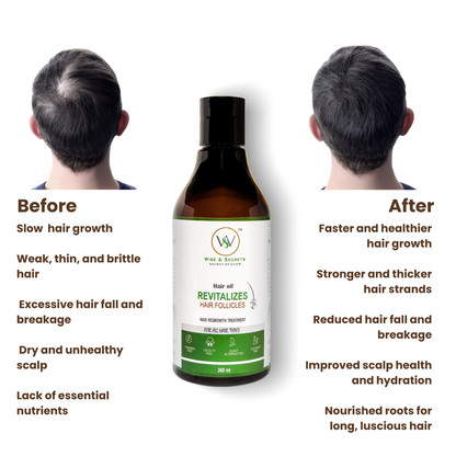 Revitalizes Hair Follicles Hair Oil - 300ml | Enriched with Gotu Kola (Centella), Bhringraj, Amla & Hibiscus | Natural Hair Growth & Nourishment
