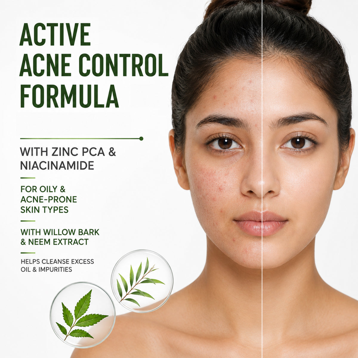 Anti-Acne Face Wash - 100 ml